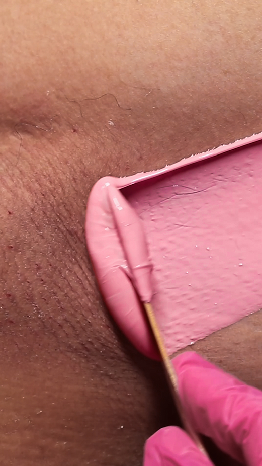 Pink Plumeria wax applied to a client's underarm by a gloved esthetician